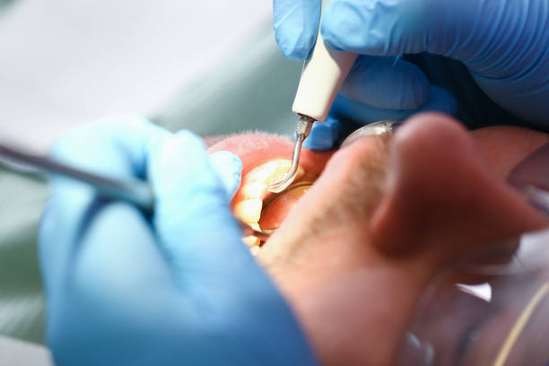 Best Emergency Denture Repair in North Hobbs, NM