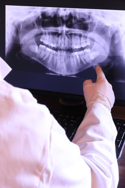 Best Emergency Root Canal Treatment in North Hobbs, NM